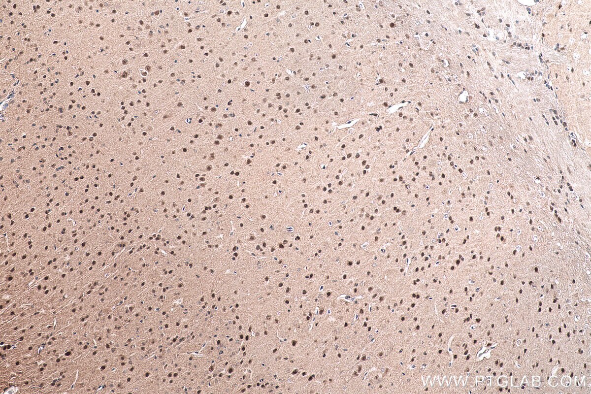 Immunohistochemical analysis of paraffin-embedded mouse brain tissue slide using KHC0903 (TSN IHC Kit).