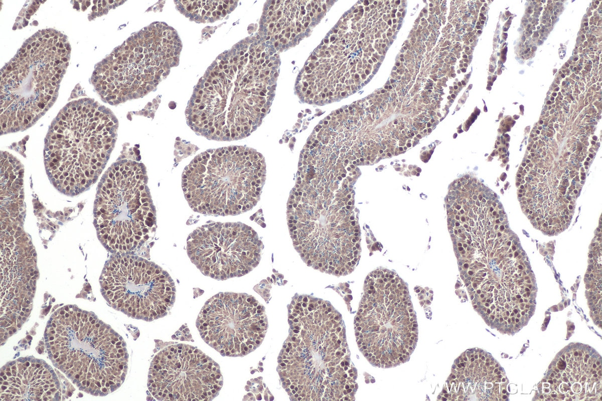 Immunohistochemical analysis of paraffin-embedded mouse testis tissue slide using KHC0903 (TSN IHC Kit).