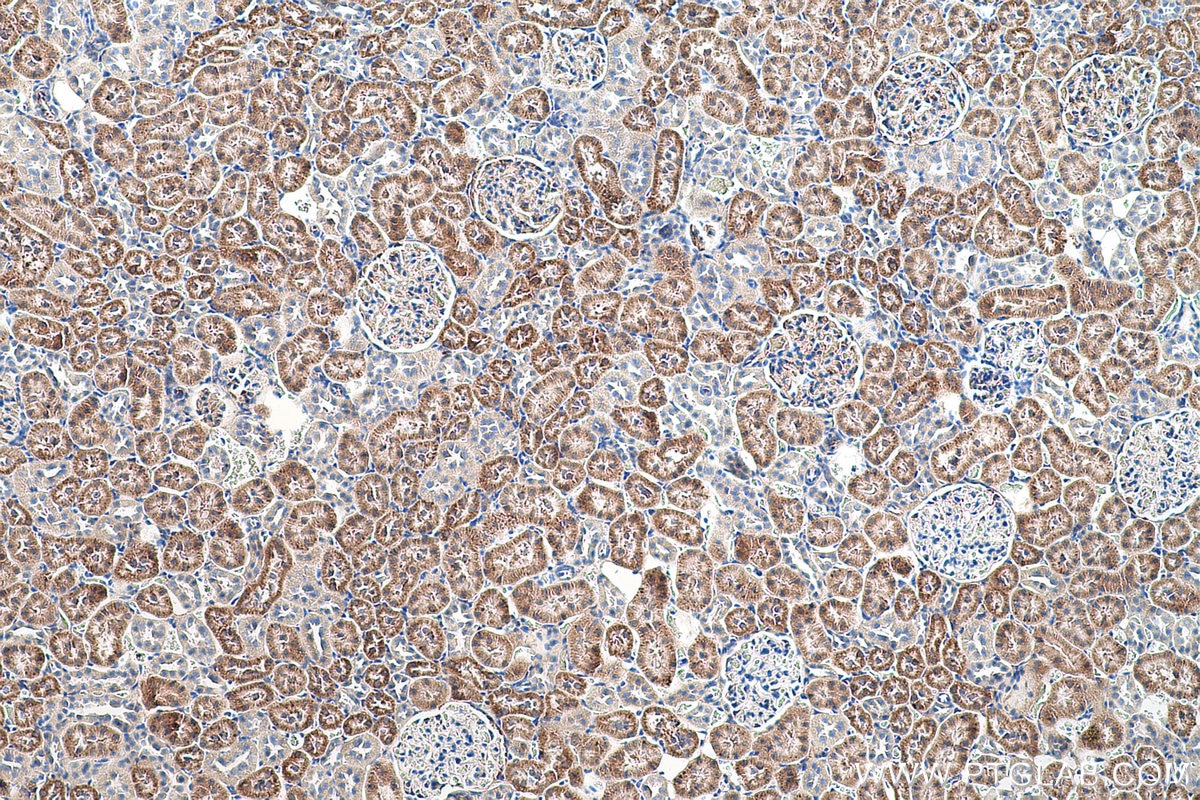 Immunohistochemical analysis of paraffin-embedded rat kidney tissue slide using KHC0565 (TST IHC Kit).