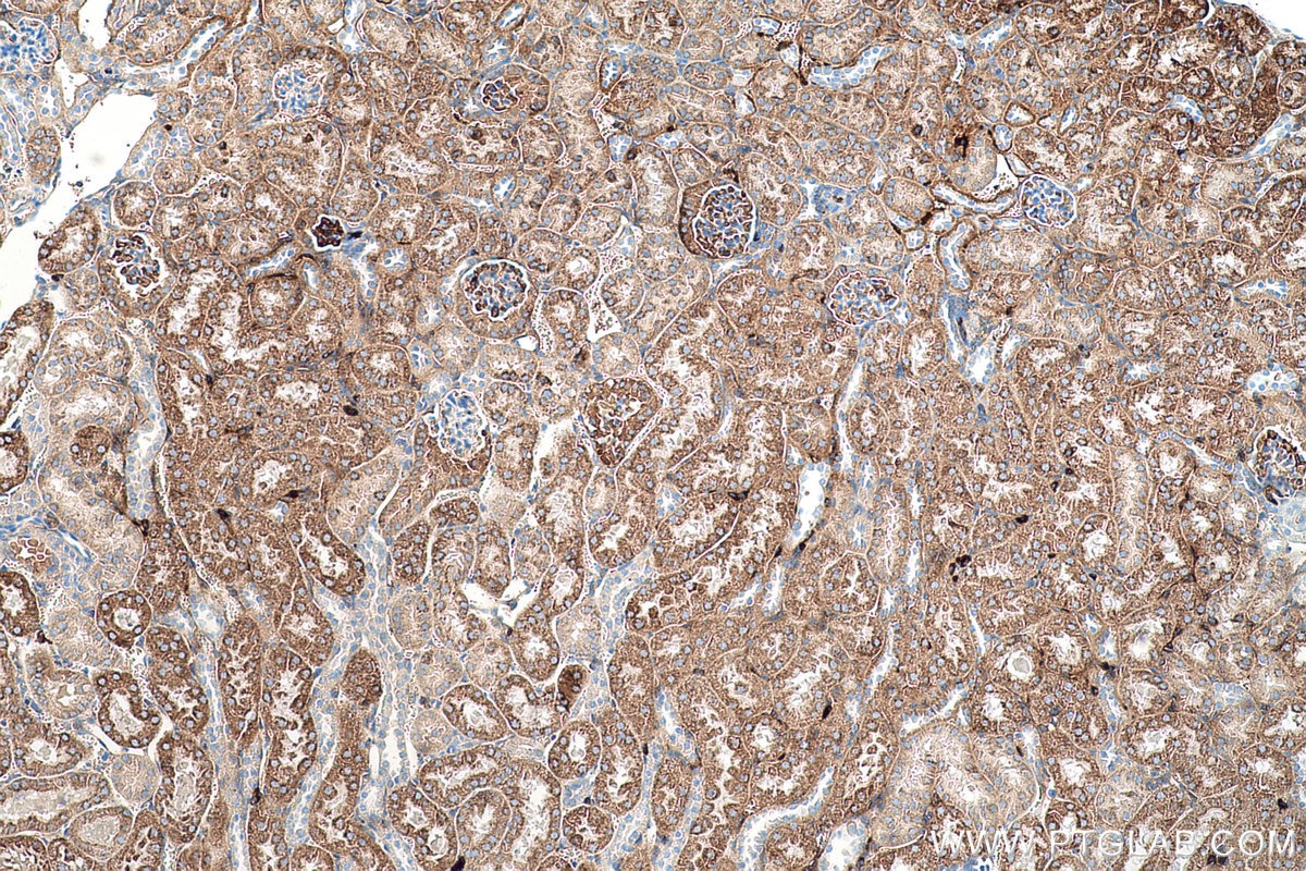 Immunohistochemical analysis of paraffin-embedded mouse kidney tissue slide using KHC0565 (TST IHC Kit).