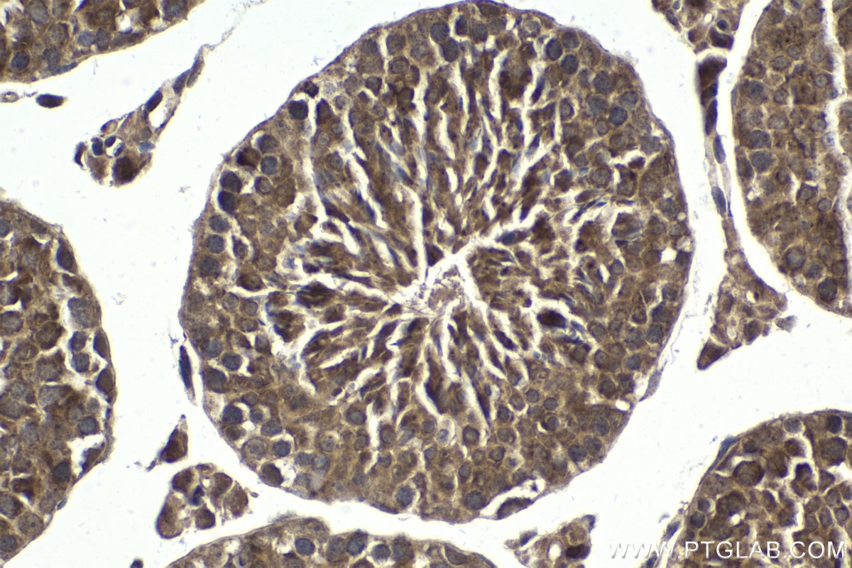 Immunohistochemical analysis of paraffin-embedded mouse testis tissue slide using KHC1829 (TTC5 IHC Kit).