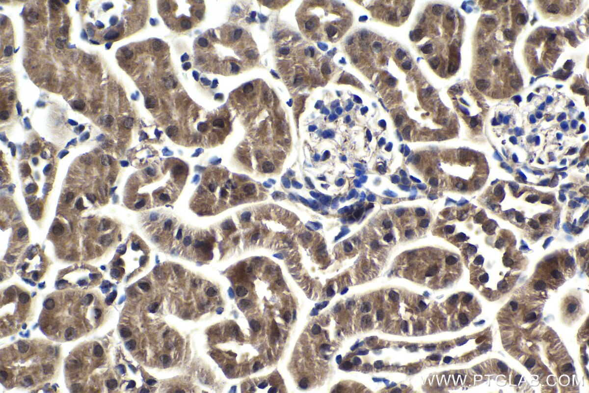 Immunohistochemical analysis of paraffin-embedded mouse kidney tissue slide using KHC1829 (TTC5 IHC Kit).