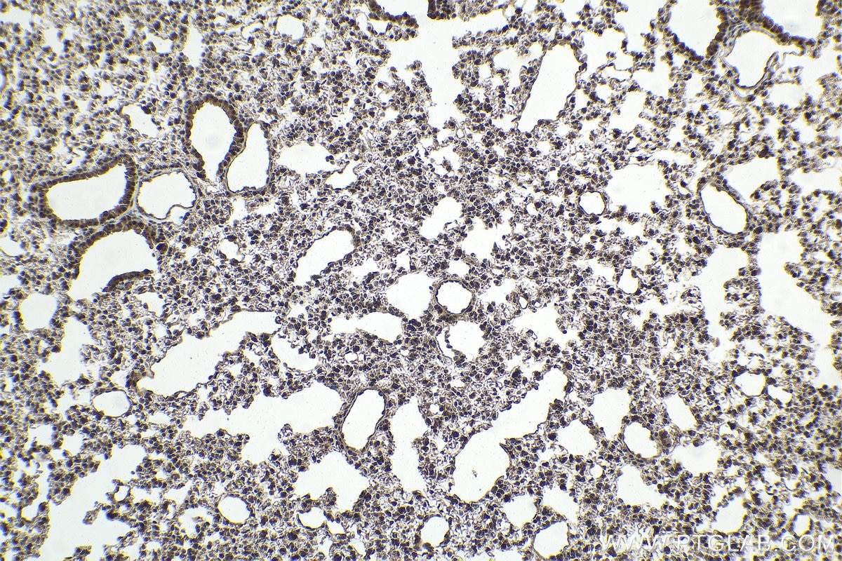 Immunohistochemical analysis of paraffin-embedded mouse lung tissue slide using KHC2007 (TTF2 IHC Kit).