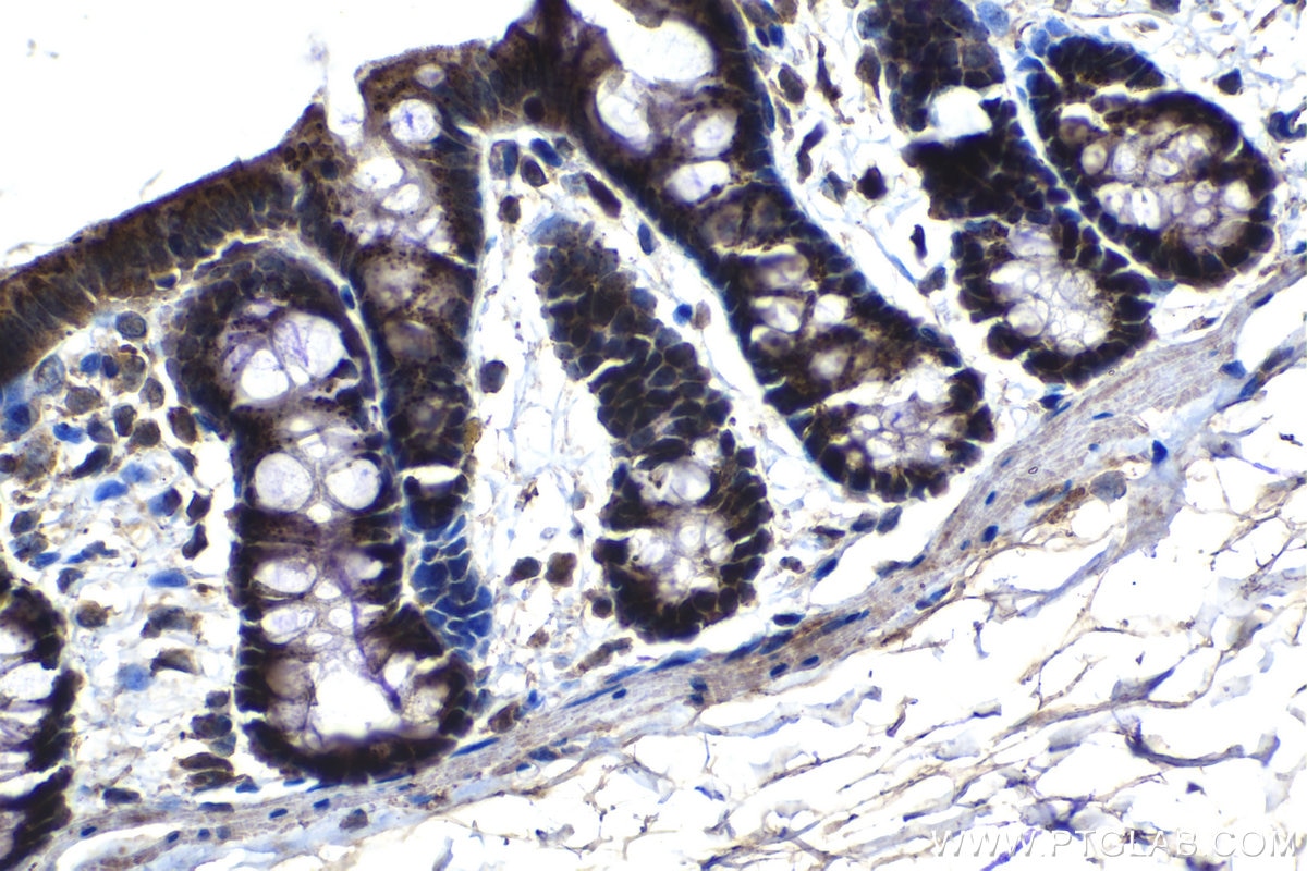 Immunohistochemical analysis of paraffin-embedded rat colon tissue slide using KHC1220 (TTK IHC Kit).