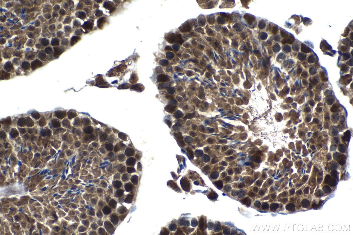 Immunohistochemical analysis of paraffin-embedded mouse testis tissue slide using KHC1220 (TTK IHC Kit).
