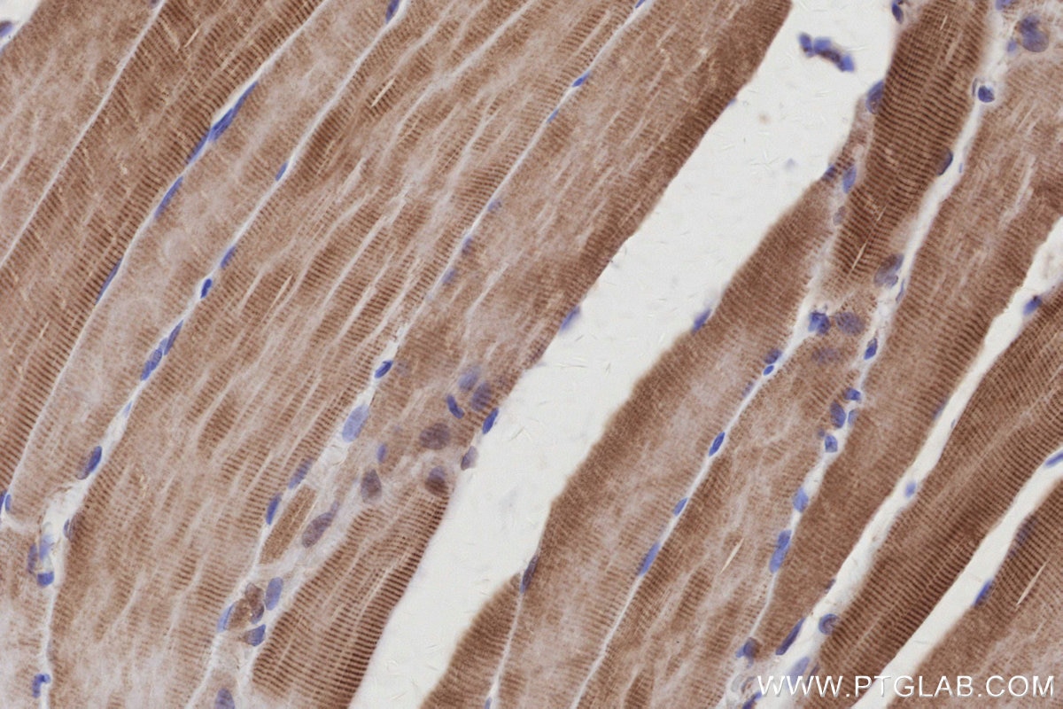 Immunohistochemical analysis of paraffin-embedded rat skeletal muscle tissue slide using KHC3107 (TTL IHC Kit). Immunohistochemical analysis of paraffin-embedded rat skeletal muscle tissue slide using KHC3107 (TTL IHC Kit).