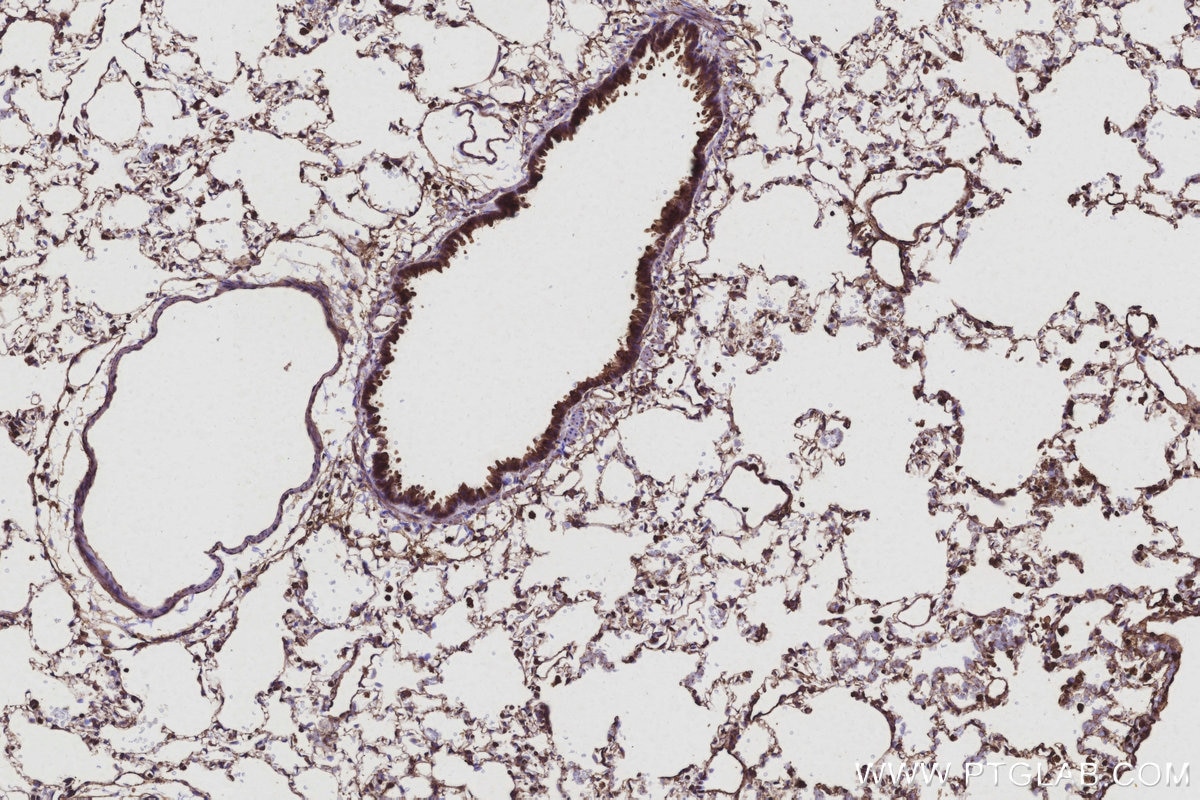 Immunohistochemical analysis of paraffin-embedded rat lung tissue slide using KHC3107 (TTL IHC Kit). Immunohistochemical analysis of paraffin-embedded rat lung tissue slide using KHC3107 (TTL IHC Kit).