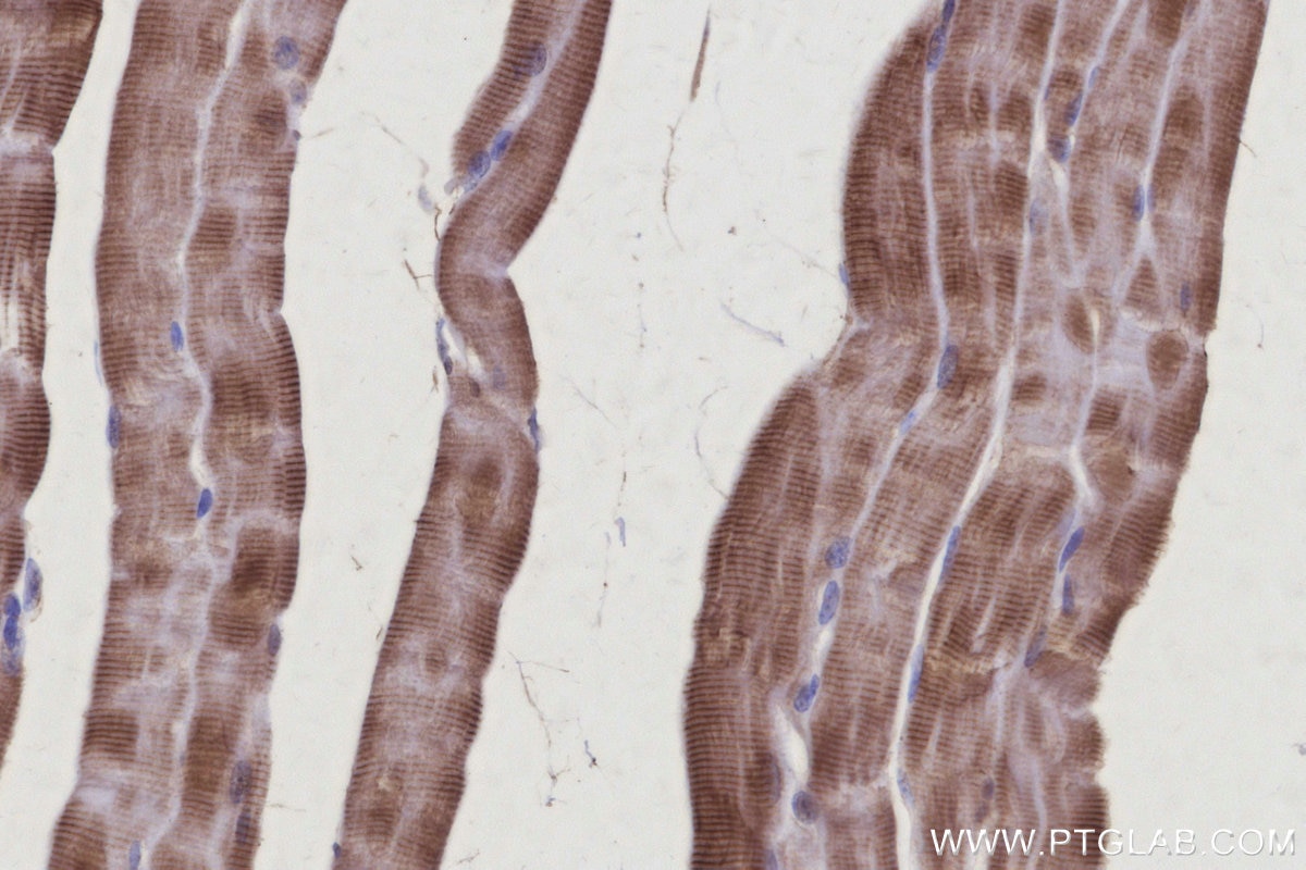 Immunohistochemical analysis of paraffin-embedded mouse skeletal muscle tissue slide using KHC3107 (TTL IHC Kit). Immunohistochemical analysis of paraffin-embedded mouse skeletal muscle tissue slide using KHC3107 (TTL IHC Kit).