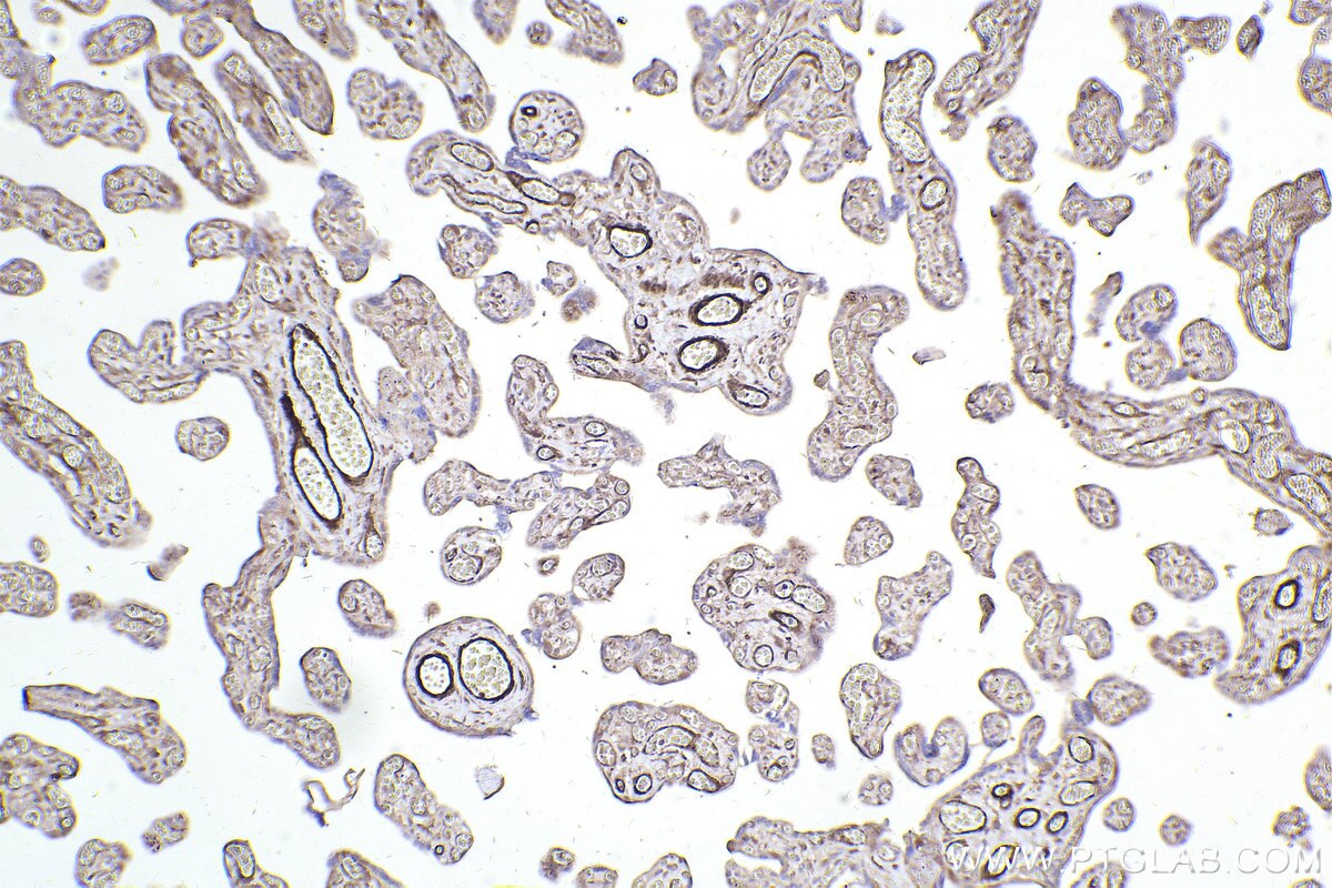 Immunohistochemical analysis of paraffin-embedded human placenta tissue slide using KHC2453 (TTLL12 IHC Kit).
