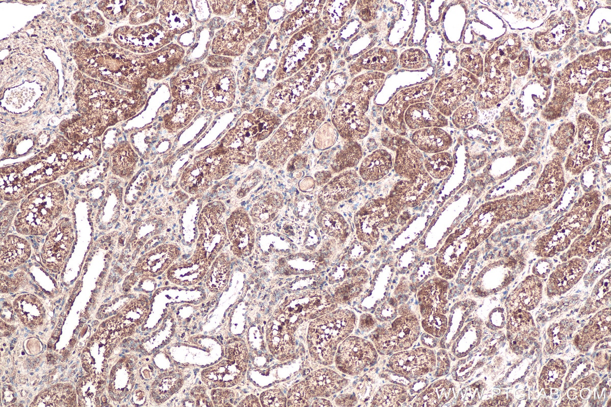 Immunohistochemical analysis of paraffin-embedded human kidney tissue slide using KHC0569 (TTPA/TPP1 IHC Kit).