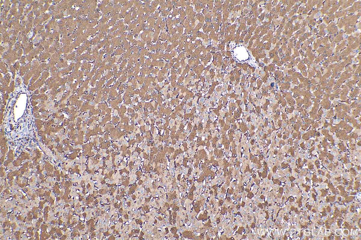 Immunohistochemical analysis of paraffin-embedded human liver tissue slide using KHC0390 (Prealbumin/transthyretin IHC Kit).