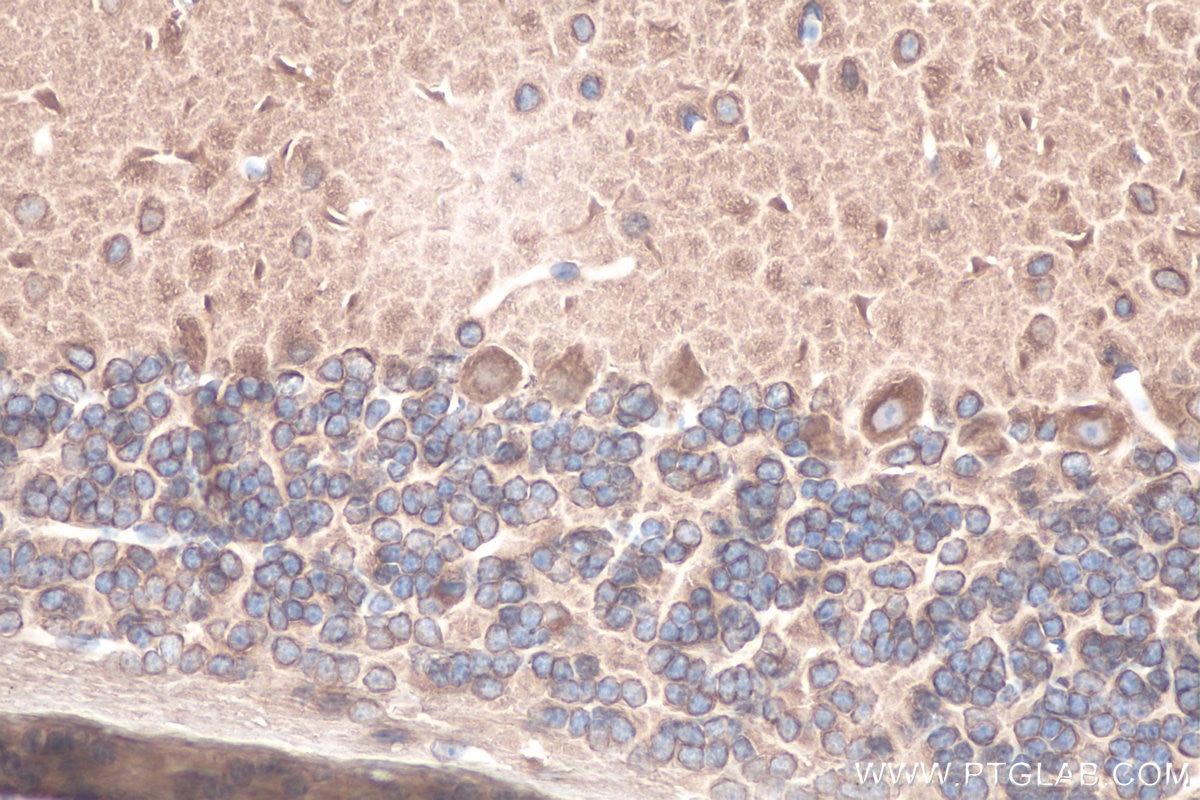 Immunohistochemical analysis of paraffin-embedded mouse cerebellum tissue slide using KHC0825 (TUBB2B IHC Kit).