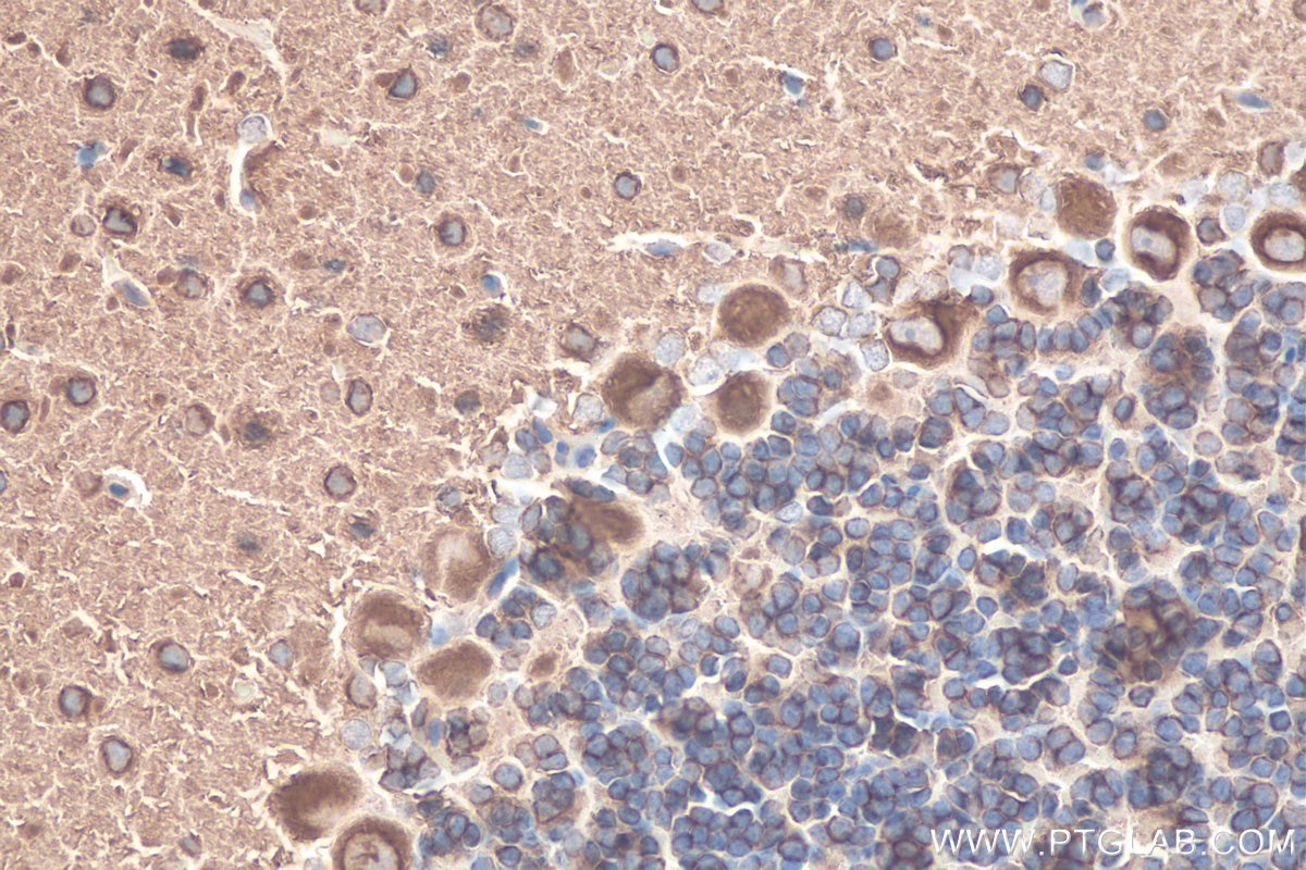 Immunohistochemical analysis of paraffin-embedded rat cerebellum tissue slide using KHC0825 (TUBB2B IHC Kit).