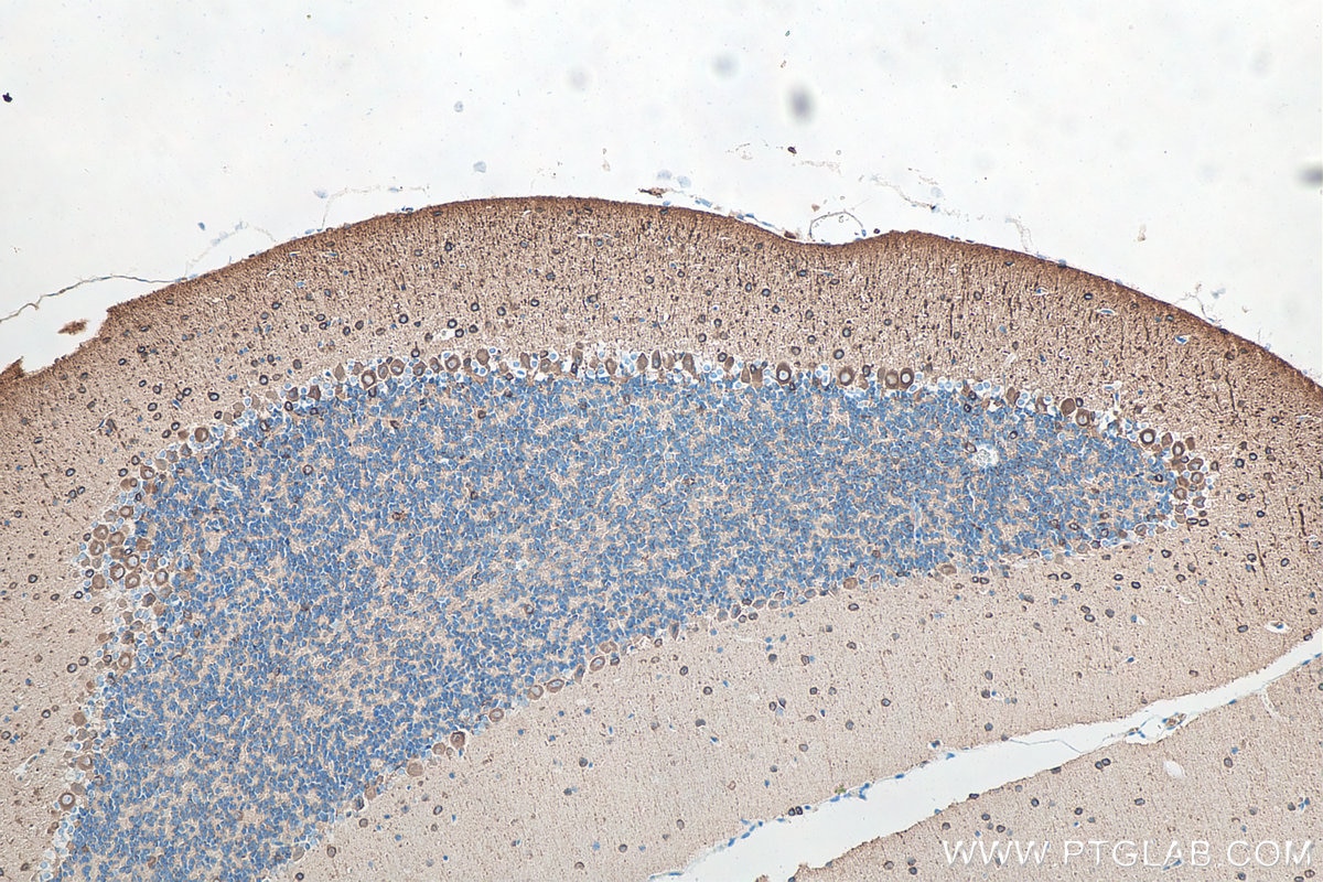 Immunohistochemical analysis of paraffin-embedded mouse cerebellum tissue slide using KHC0042 (TUBB3 IHC Kit).