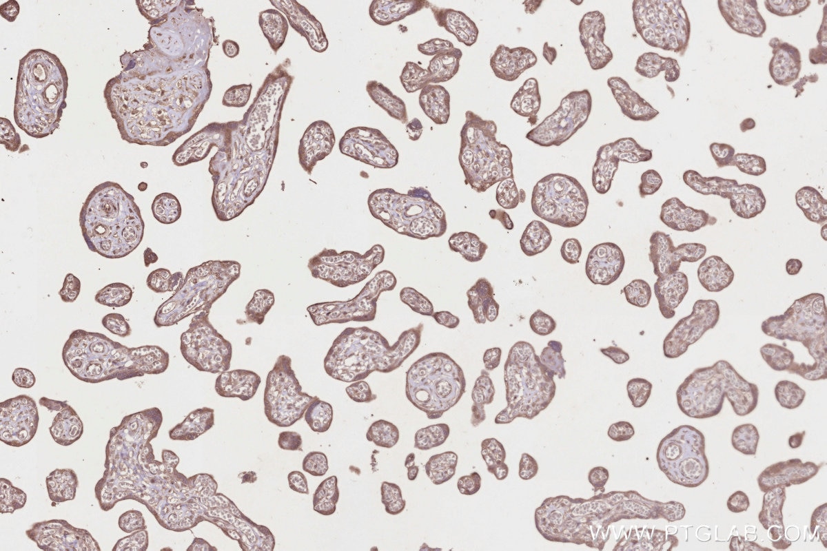 Immunohistochemical analysis of paraffin-embedded human placenta tissue slide using KHC2829 (TUBGCP5 IHC Kit).