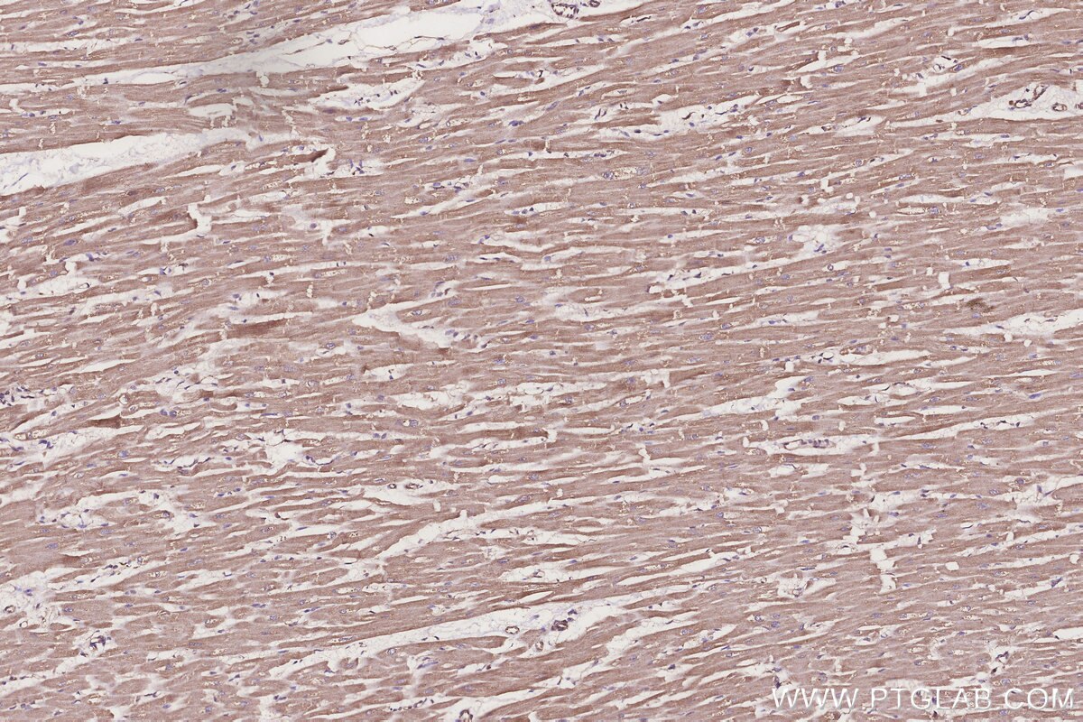 Immunohistochemical analysis of paraffin-embedded human heart tissue slide using KHC3251 (TUSC3 IHC Kit).