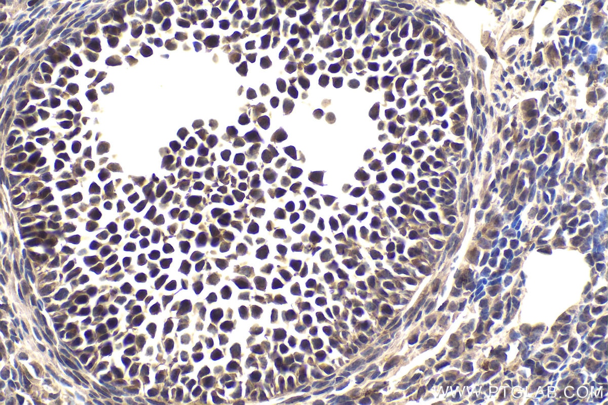 Immunohistochemical analysis of paraffin-embedded mouse ovary tissue slide using KHC1844 (TWIST2 IHC Kit).