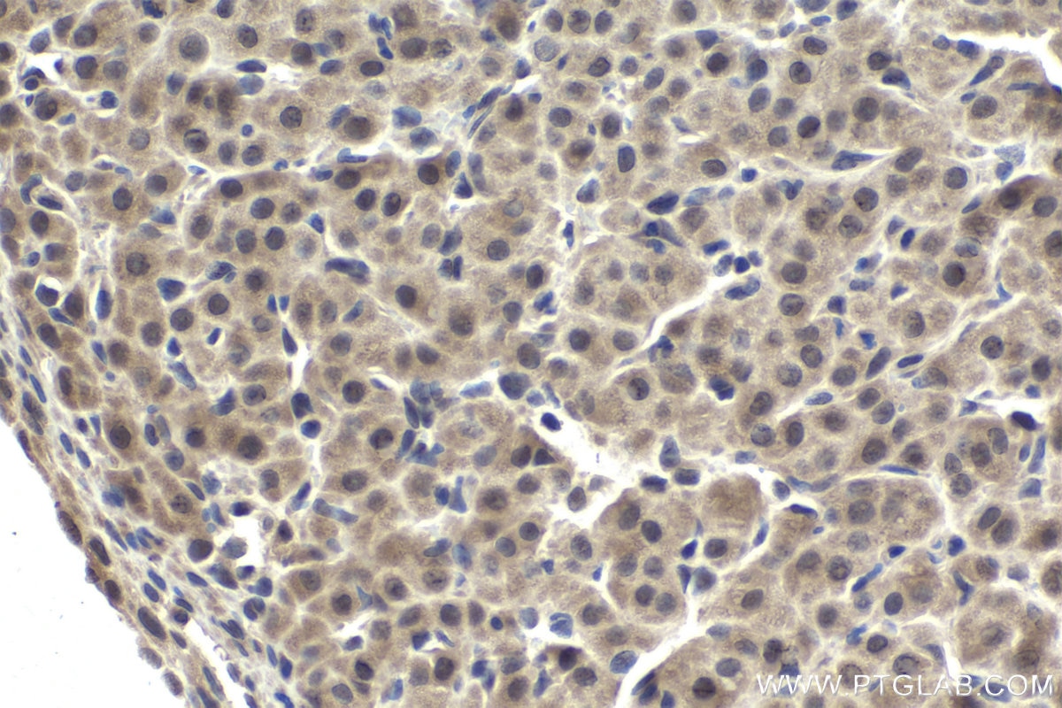 Immunohistochemical analysis of paraffin-embedded rat ovary tissue slide using KHC1844 (TWIST2 IHC Kit).