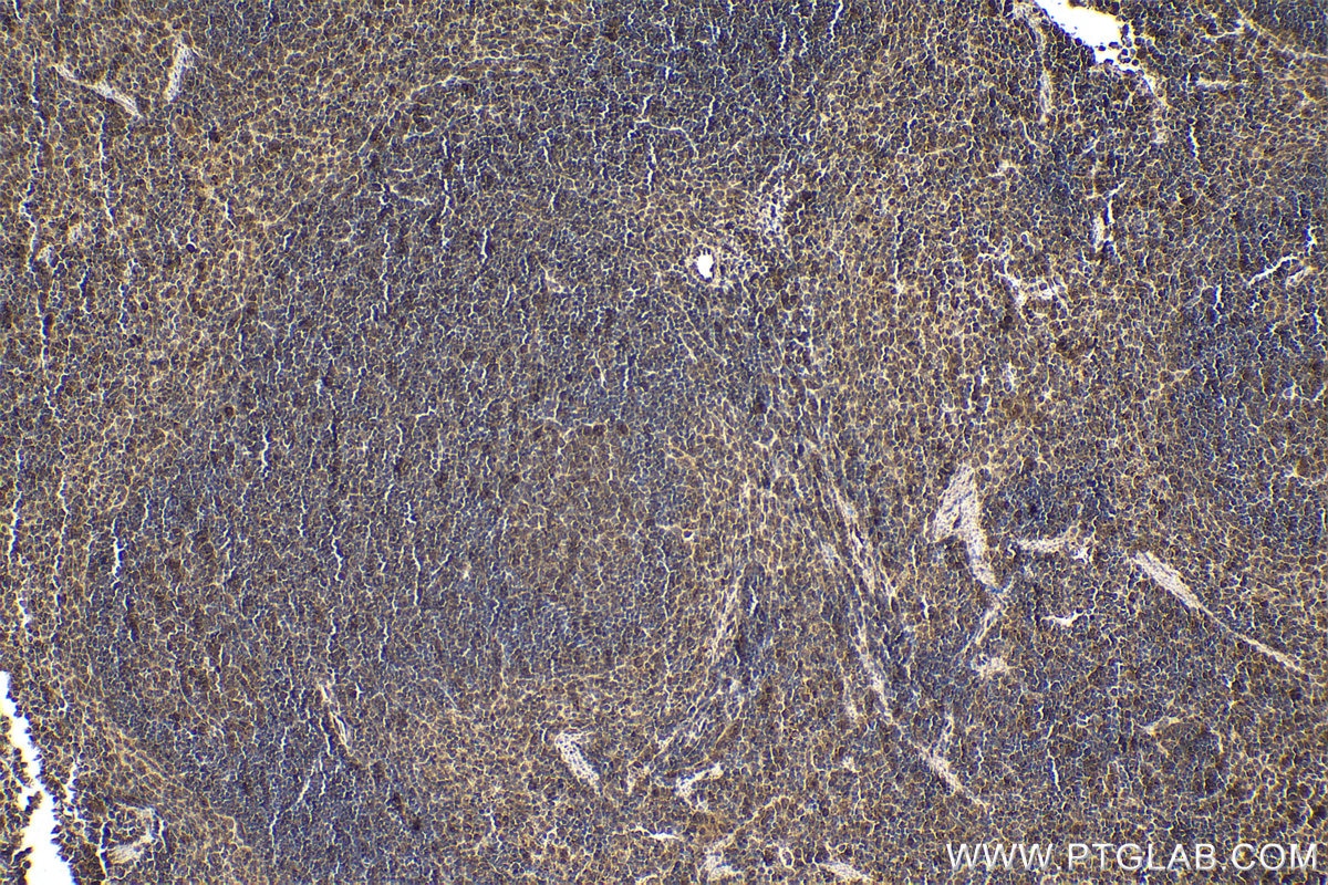 Immunohistochemical analysis of paraffin-embedded mouse spleen tissue slide using KHC1595 (TXK IHC Kit).