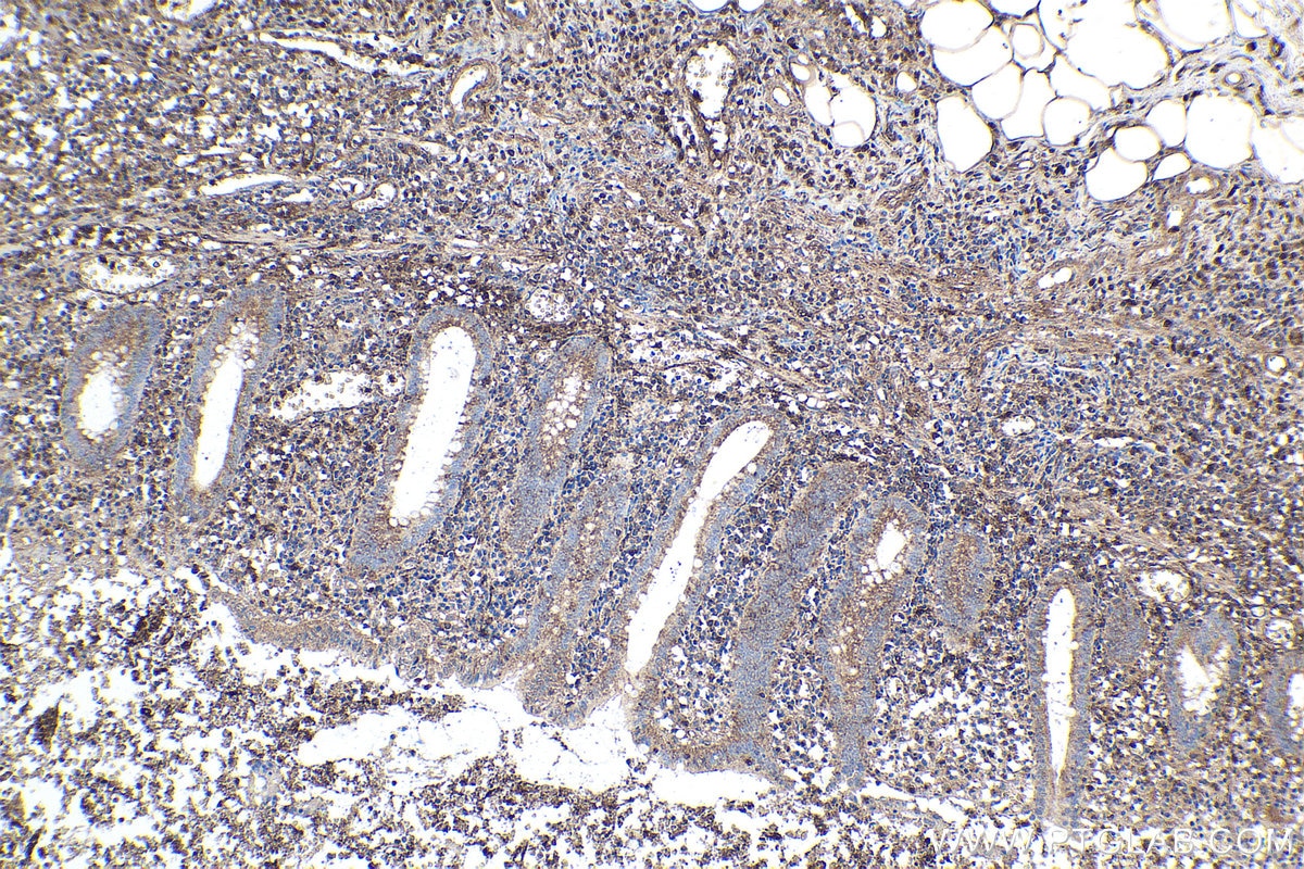 Immunohistochemical analysis of paraffin-embedded human appendicitis tissue slide using KHC1595 (TXK IHC Kit).