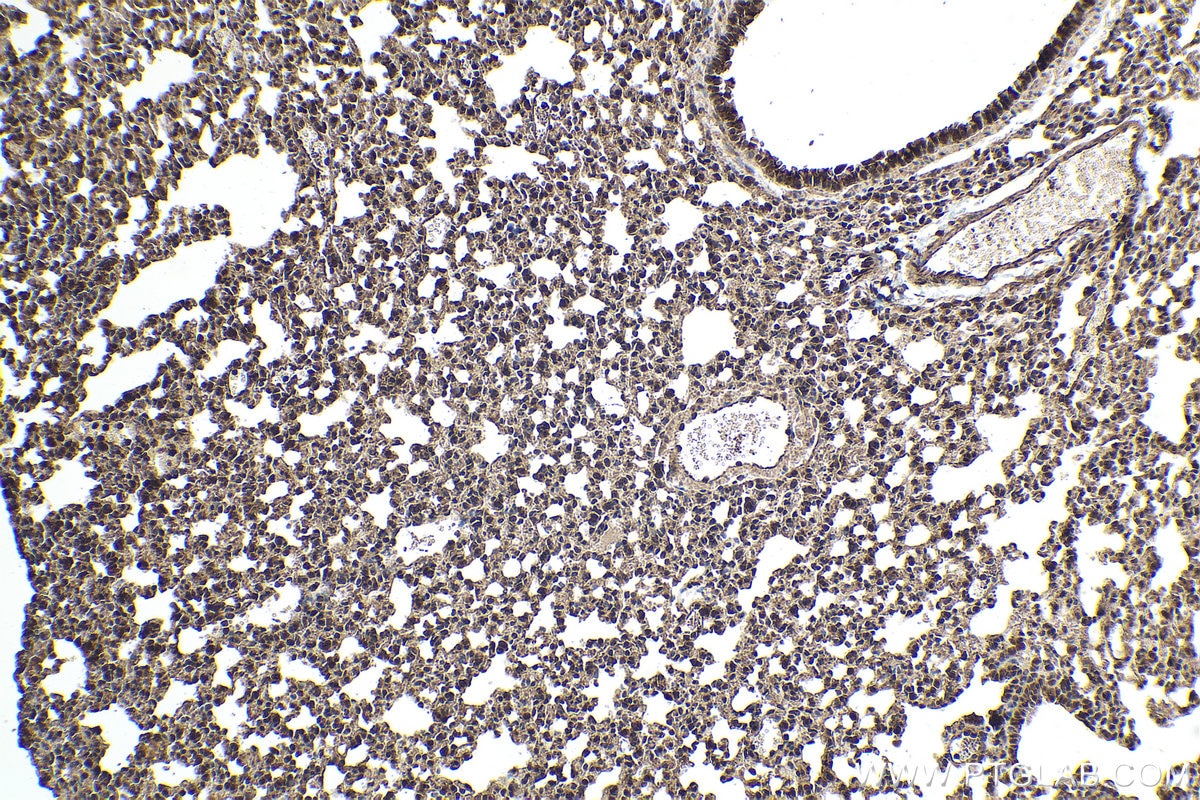 Immunohistochemical analysis of paraffin-embedded mouse lung tissue slide using KHC1595 (TXK IHC Kit).