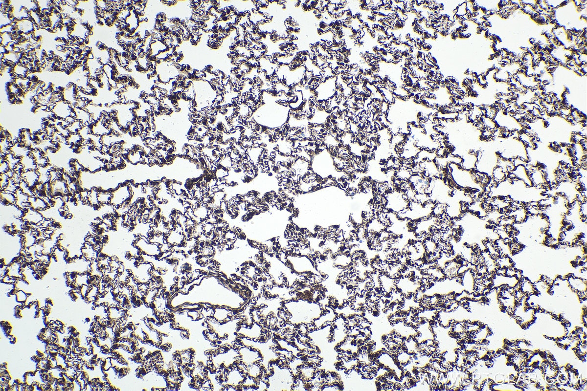 Immunohistochemical analysis of paraffin-embedded rat lung tissue slide using KHC1595 (TXK IHC Kit).