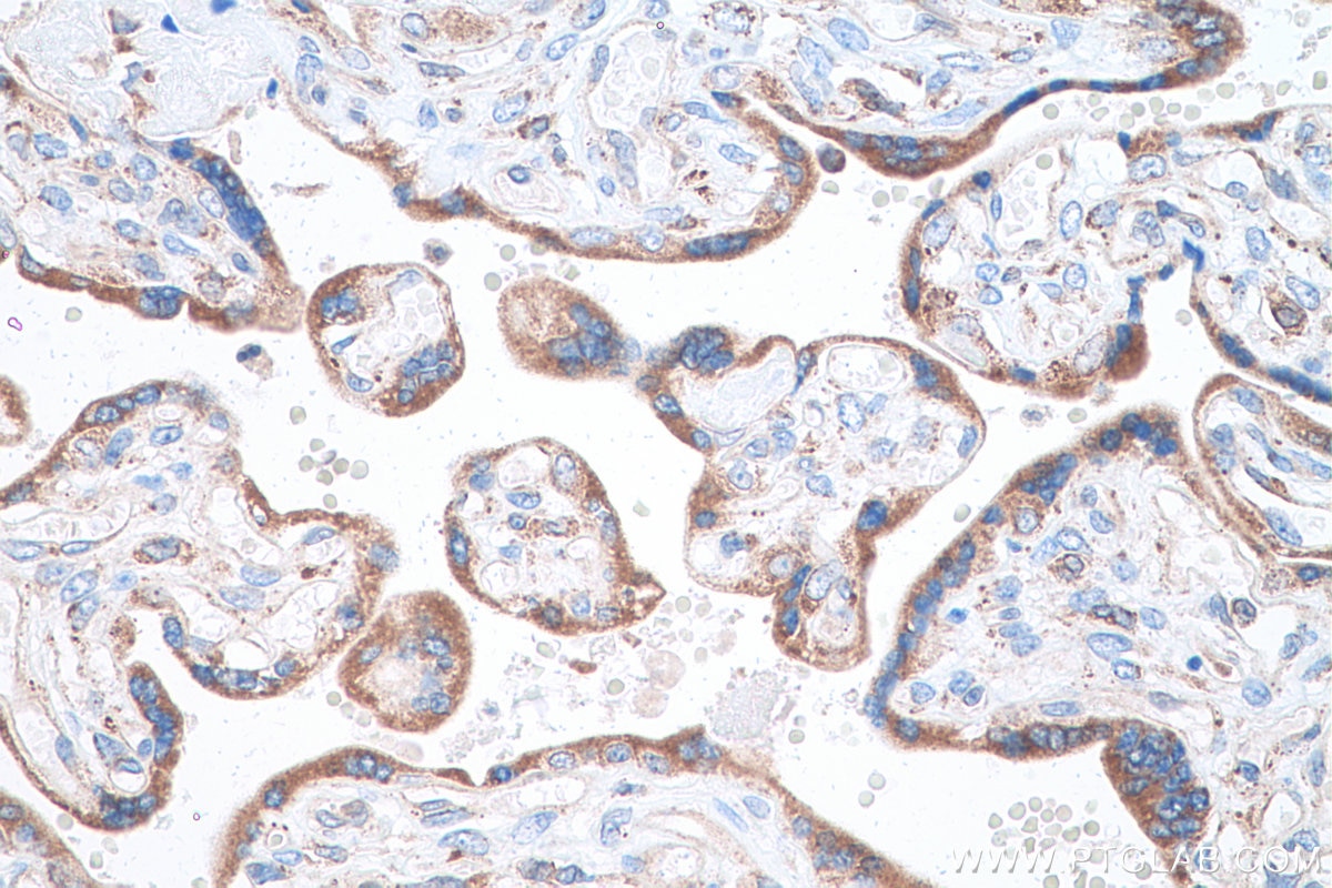 Immunohistochemical analysis of paraffin-embedded human placenta tissue slide using KHC0855 (TXNDC12 IHC Kit).
