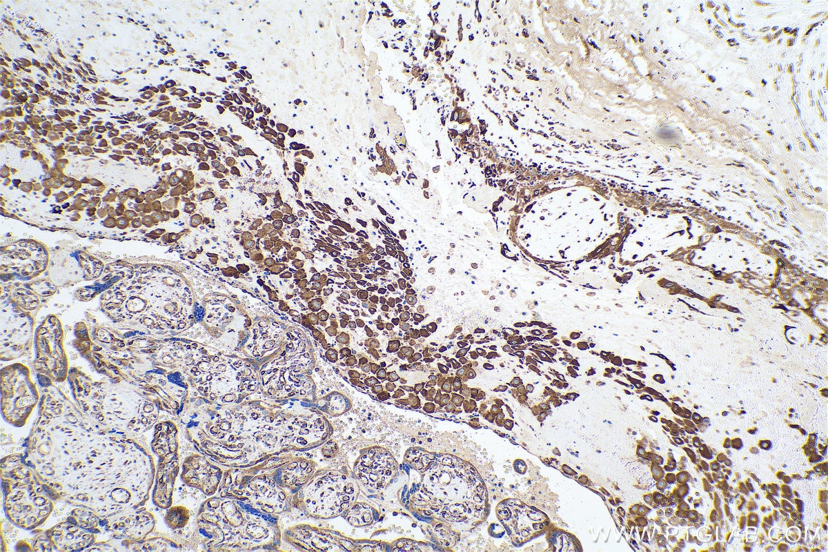 Immunohistochemical analysis of paraffin-embedded human placenta tissue slide using KHC0685 (TXNDC5 IHC Kit).