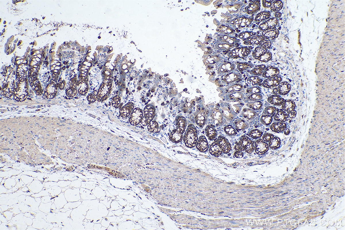 Immunohistochemical analysis of paraffin-embedded rat colon tissue slide using KHC0685 (TXNDC5 IHC Kit).