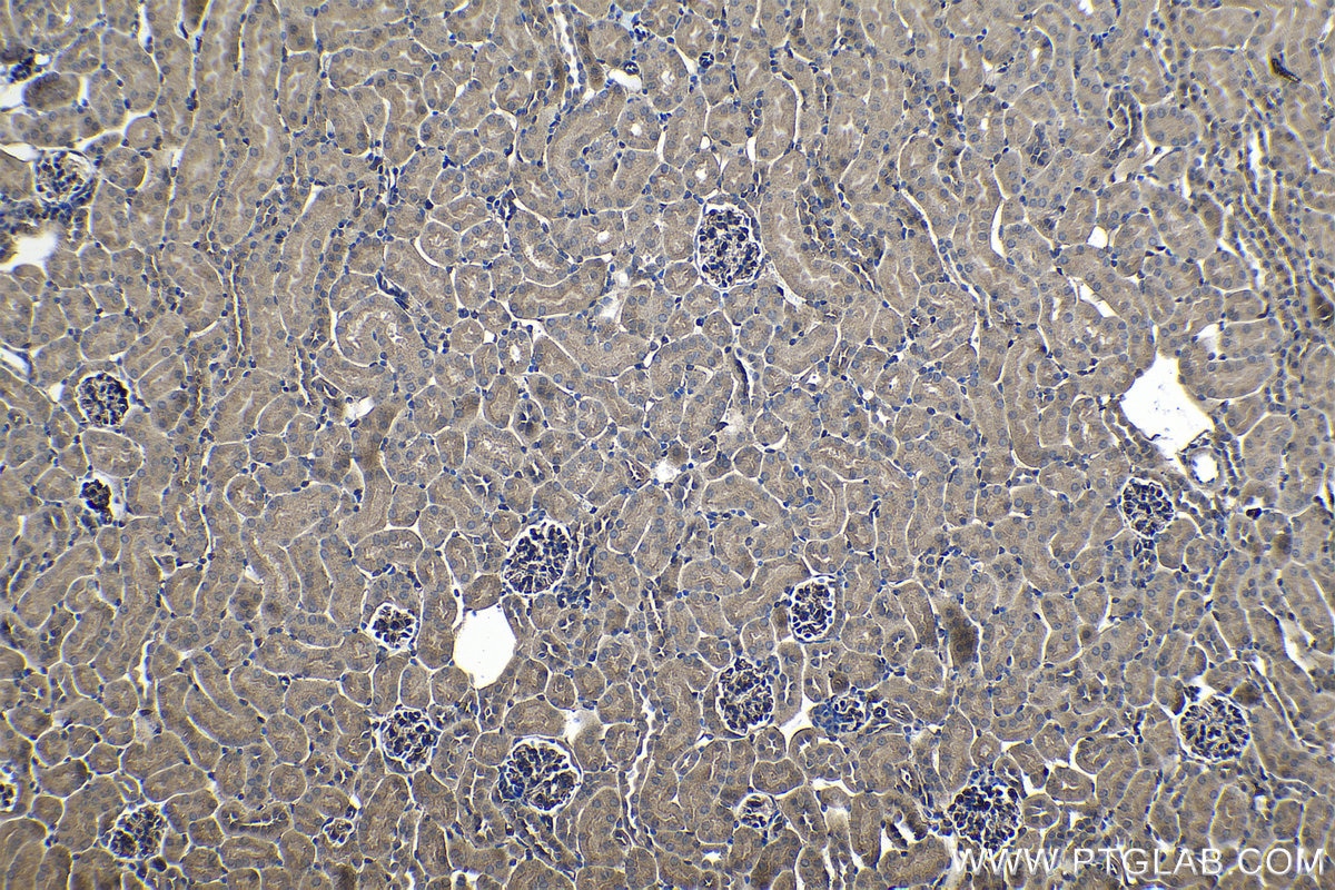 Immunohistochemical analysis of paraffin-embedded mouse kidney tissue slide using KHC1303 (TXNL1 IHC Kit).