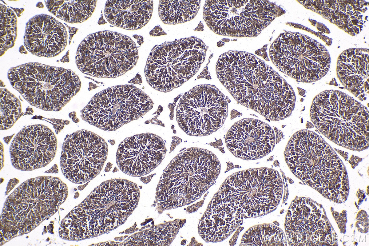 Immunohistochemical analysis of paraffin-embedded mouse testis tissue slide using KHC1766 (TXNRD1 IHC Kit).