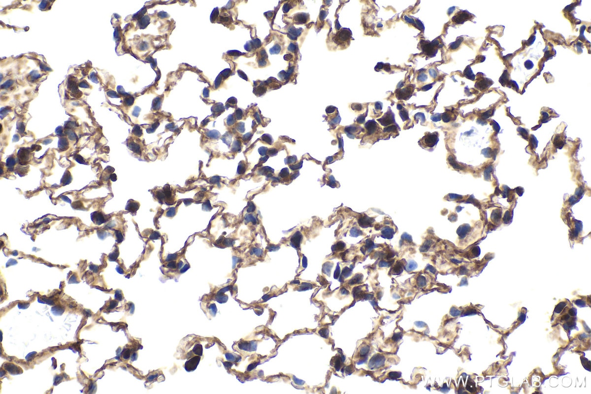 Immunohistochemical analysis of paraffin-embedded mouse lung tissue slide using KHC1766 (TXNRD1 IHC Kit).