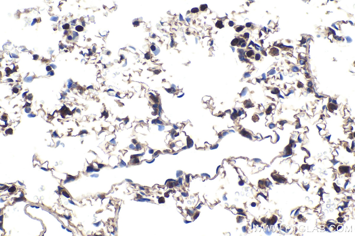 Immunohistochemical analysis of paraffin-embedded rat lung tissue slide using KHC1766 (TXNRD1 IHC Kit).