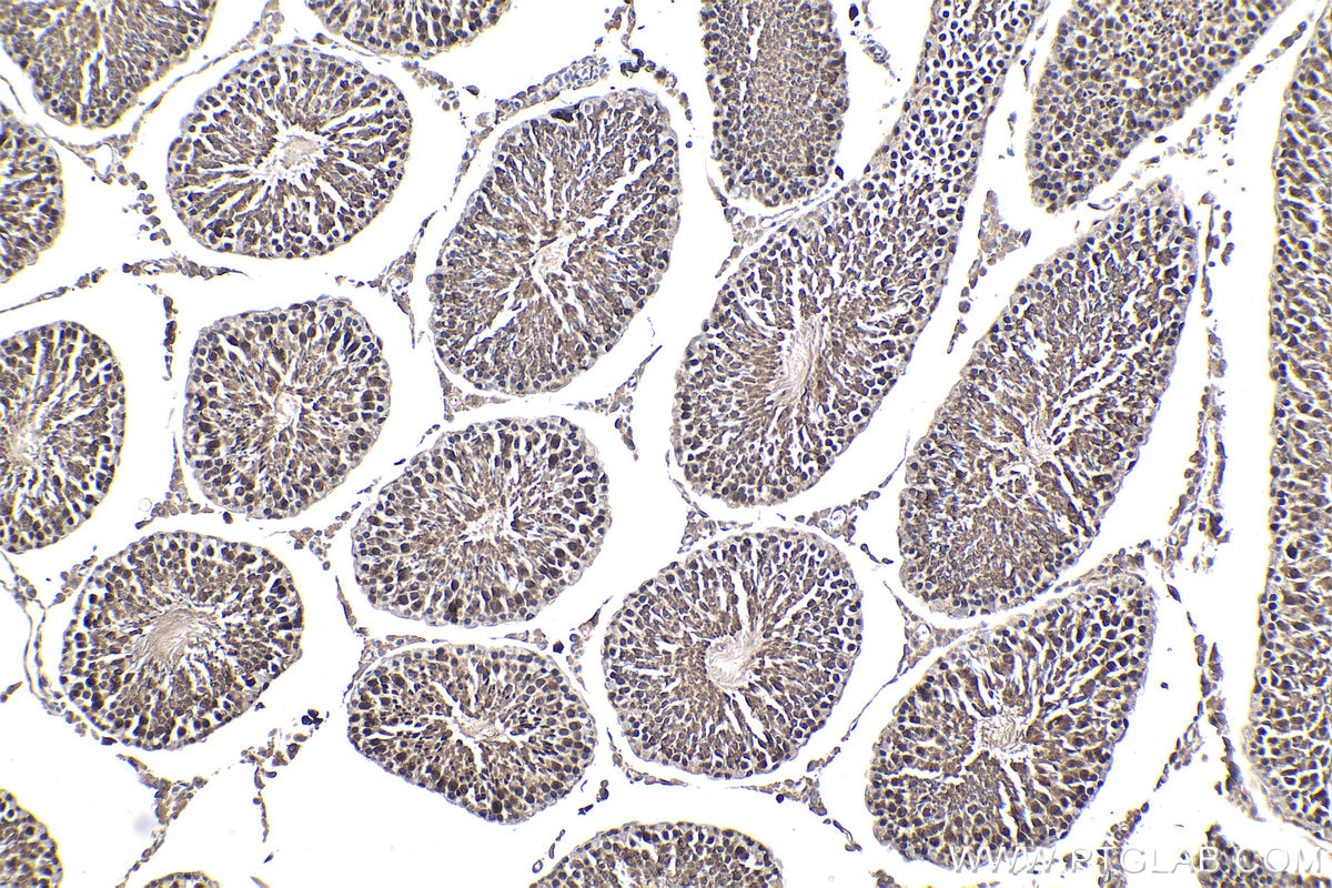Immunohistochemical analysis of paraffin-embedded rat testis tissue slide using KHC1766 (TXNRD1 IHC Kit).