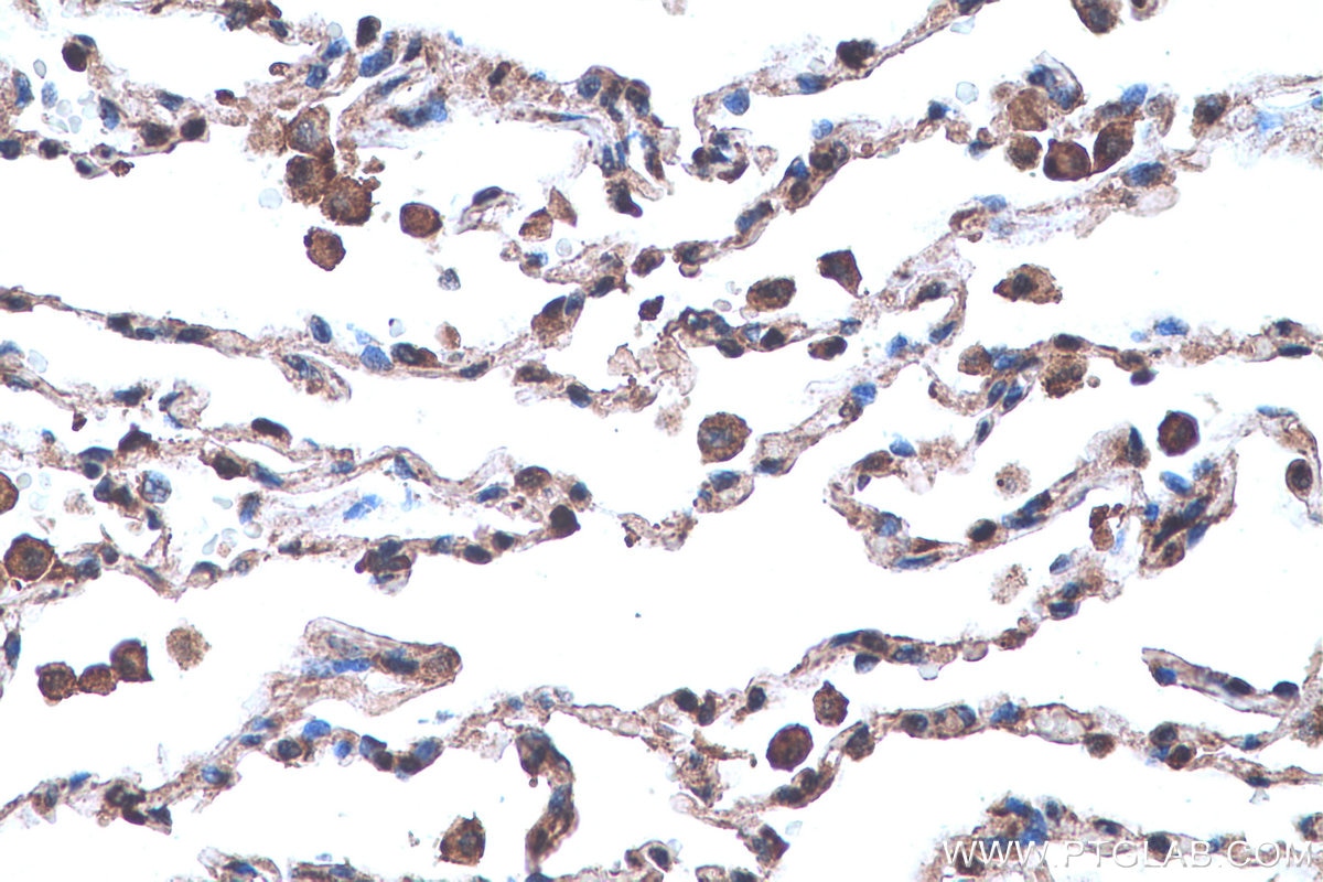Immunohistochemical analysis of paraffin-embedded human lung tissue slide using KHC0649 (TYMS IHC Kit).
