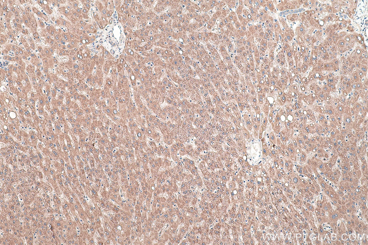 Immunohistochemical analysis of paraffin-embedded human liver tissue slide using KHC0469 (TYW3 IHC Kit).