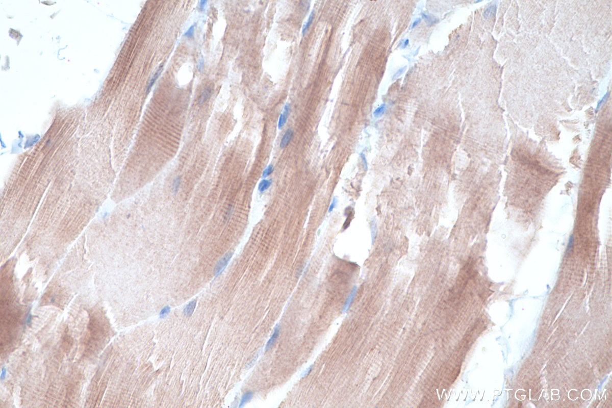 Immunohistochemical analysis of paraffin-embedded rat skeletal muscle tissue slide using KHC0312 (Telethonin IHC Kit).