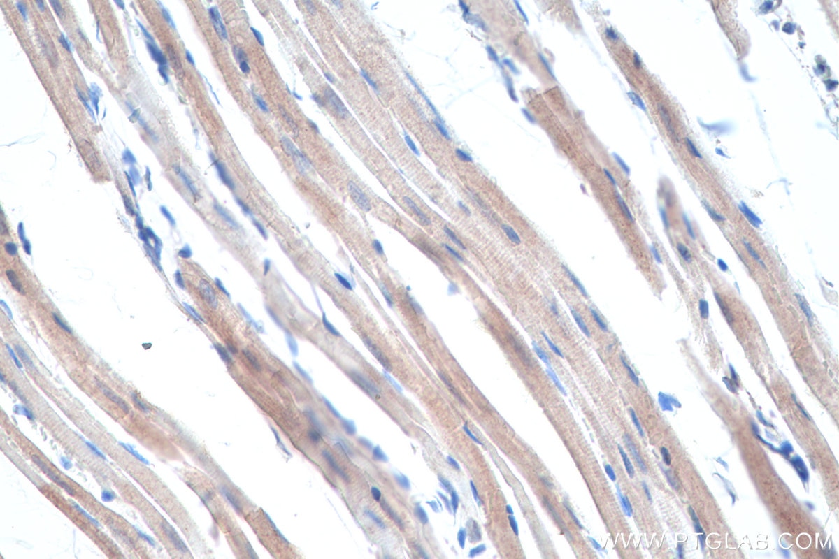 Immunohistochemical analysis of paraffin-embedded rat heart tissue slide using KHC0312 (Telethonin IHC Kit).