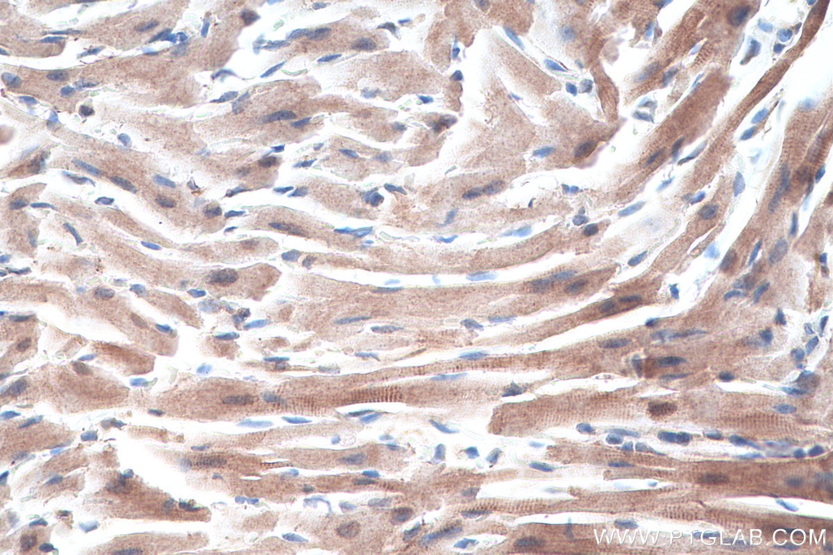 Immunohistochemical analysis of paraffin-embedded mouse heart tissue slide using KHC0312 (Telethonin IHC Kit).