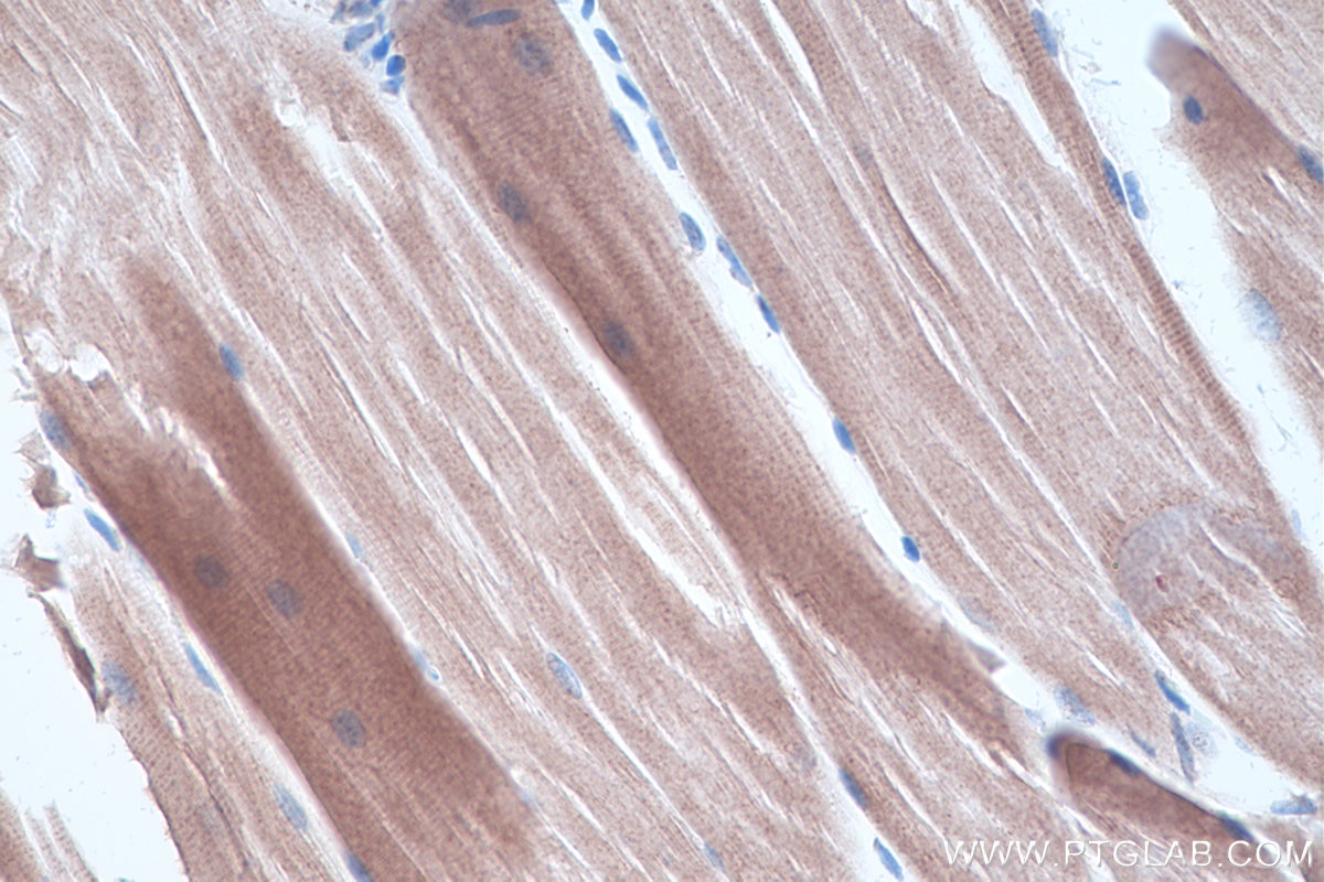 Immunohistochemical analysis of paraffin-embedded mouse skeletal muscle tissue slide using KHC0312 (Telethonin IHC Kit).