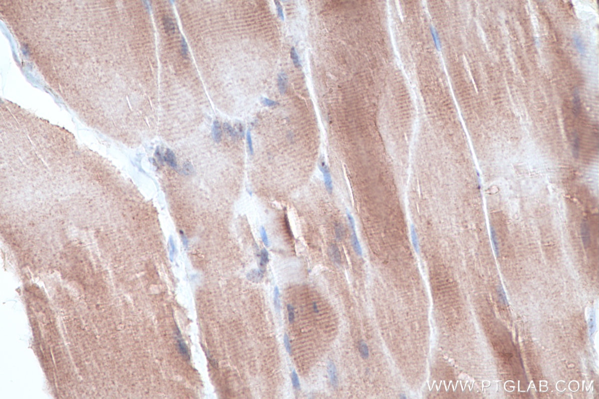Immunohistochemical analysis of paraffin-embedded rat skeletal muscle tissue slide using KHC0313 (Titin IHC Kit).