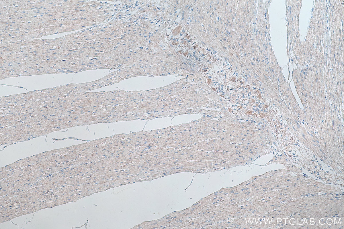 Immunohistochemical analysis of paraffin-embedded human colon tissue slide using KHC0313 (Titin IHC Kit).