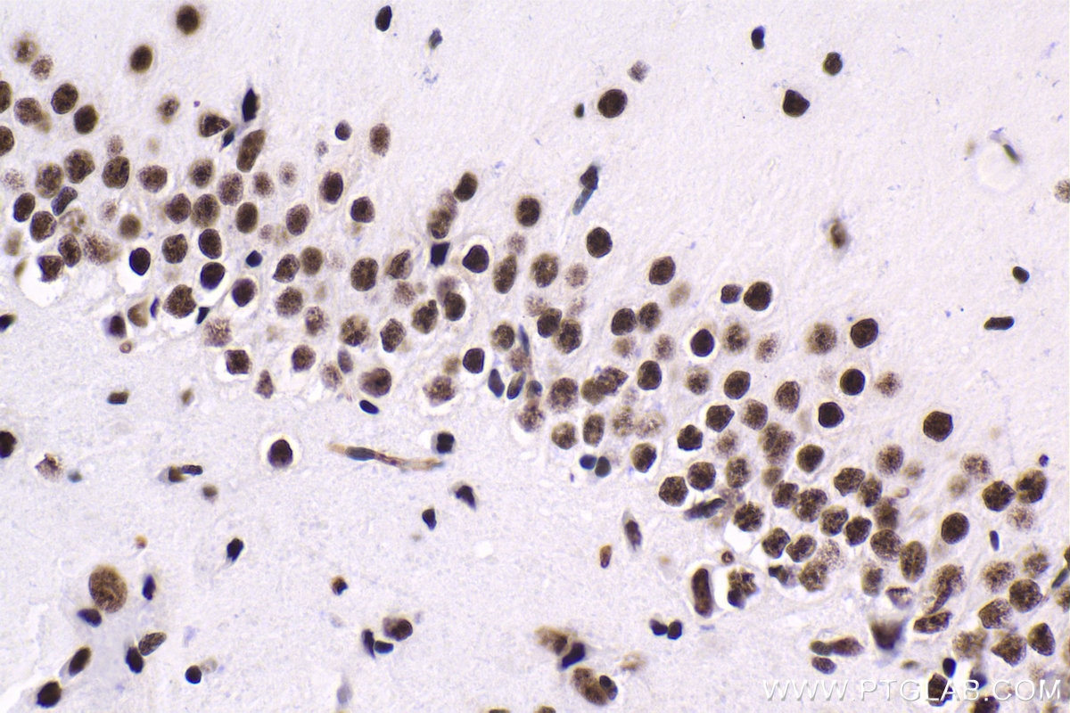 Immunohistochemical analysis of paraffin-embedded rat brain tissue slide using KHC1661 (U2AF1 IHC Kit).