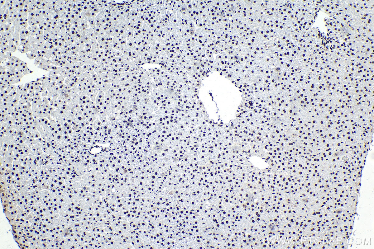 Immunohistochemical analysis of paraffin-embedded rat liver tissue slide using KHC1566 (U2AF2 IHC Kit).