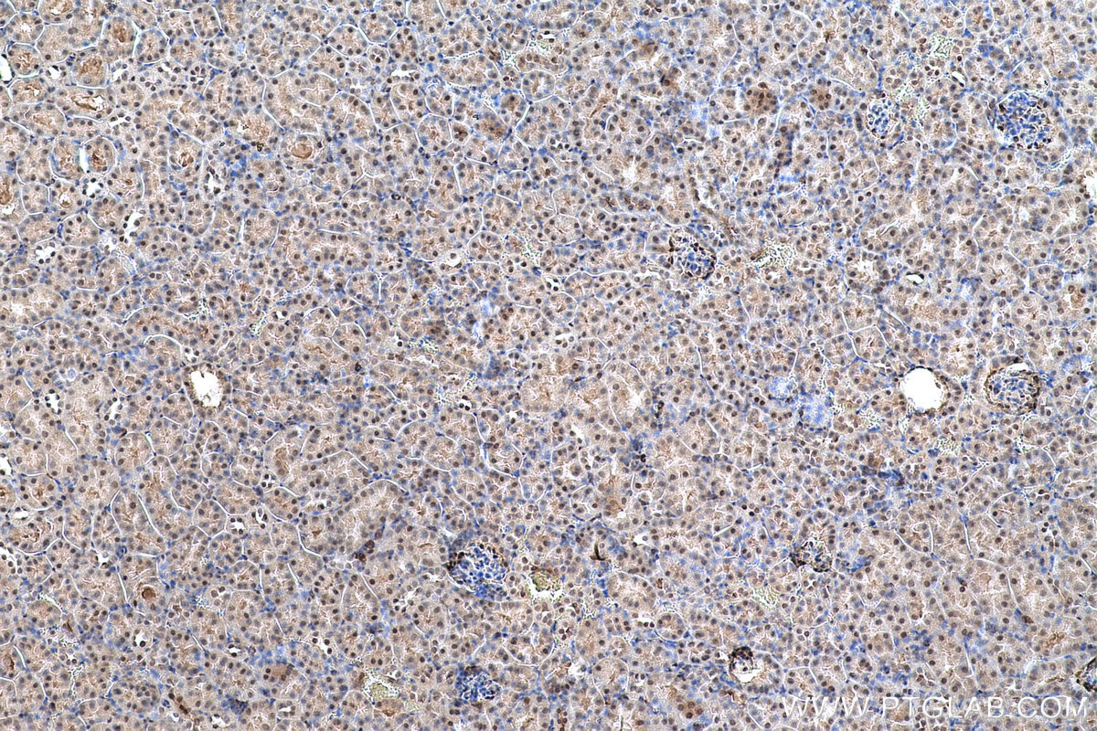 Immunohistochemical analysis of paraffin-embedded mouse kidney tissue slide using KHC0679 (UBA1 IHC Kit).