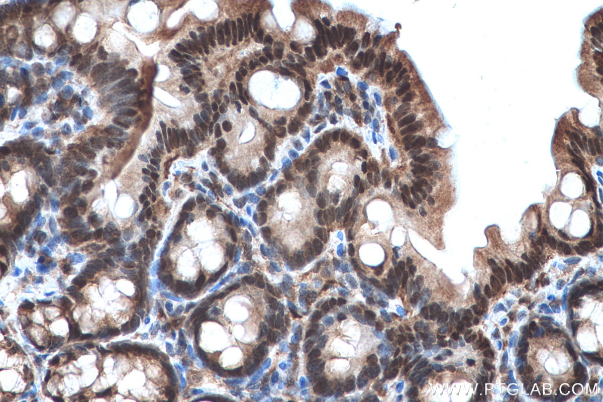 Immunohistochemical analysis of paraffin-embedded rat colon tissue slide using KHC0679 (UBA1 IHC Kit).