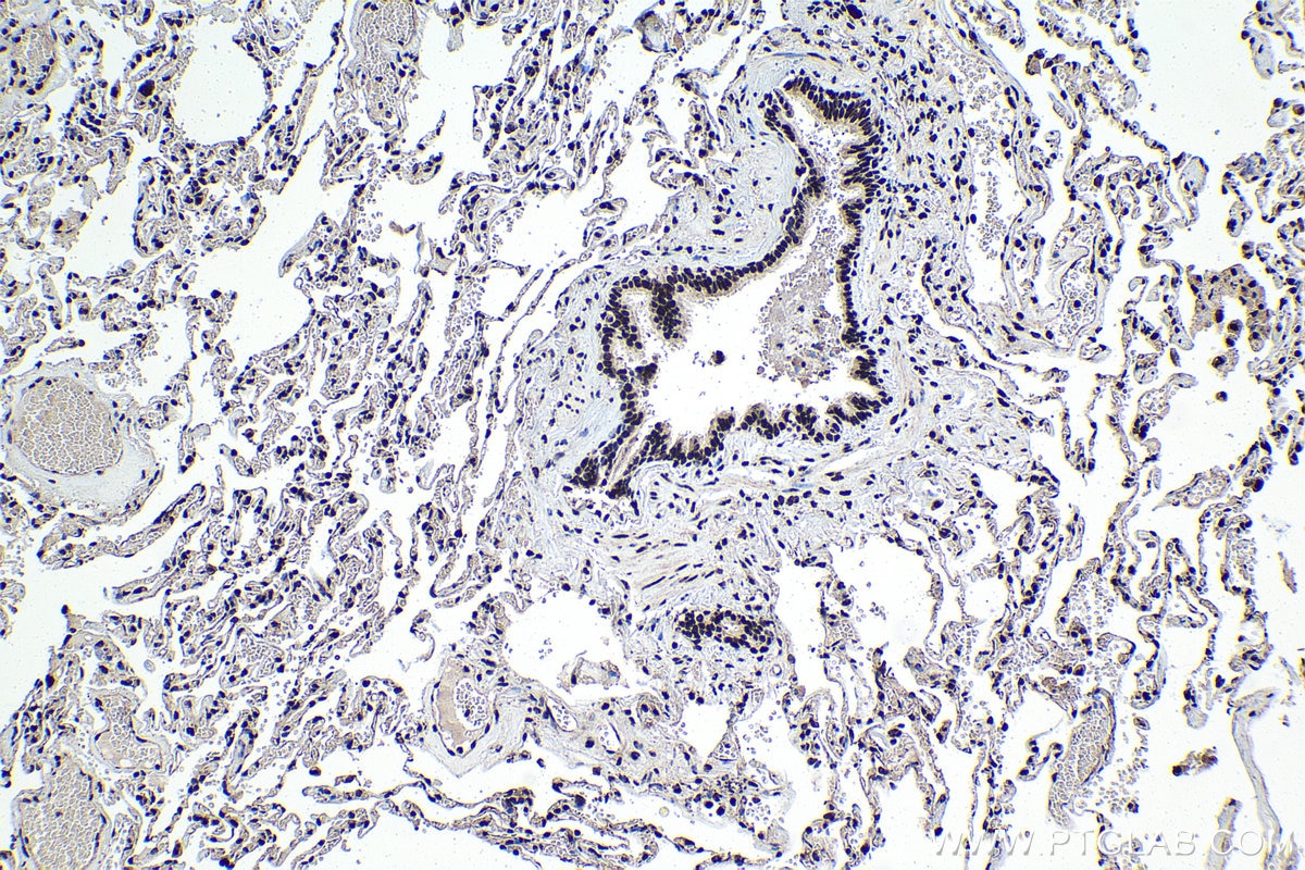 Immunohistochemical analysis of paraffin-embedded human lung tissue slide using KHC1394 (UBA2 IHC Kit).