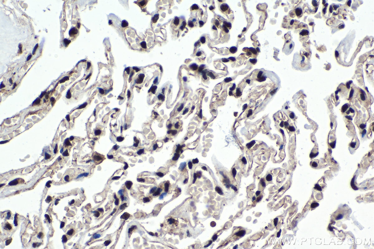 Immunohistochemical analysis of paraffin-embedded human lung tissue slide using KHC1394 (UBA2 IHC Kit).