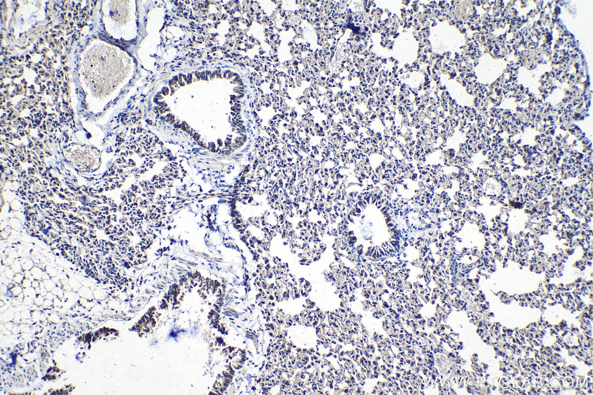 Immunohistochemical analysis of paraffin-embedded mouse lung tissue slide using KHC1394 (UBA2 IHC Kit).