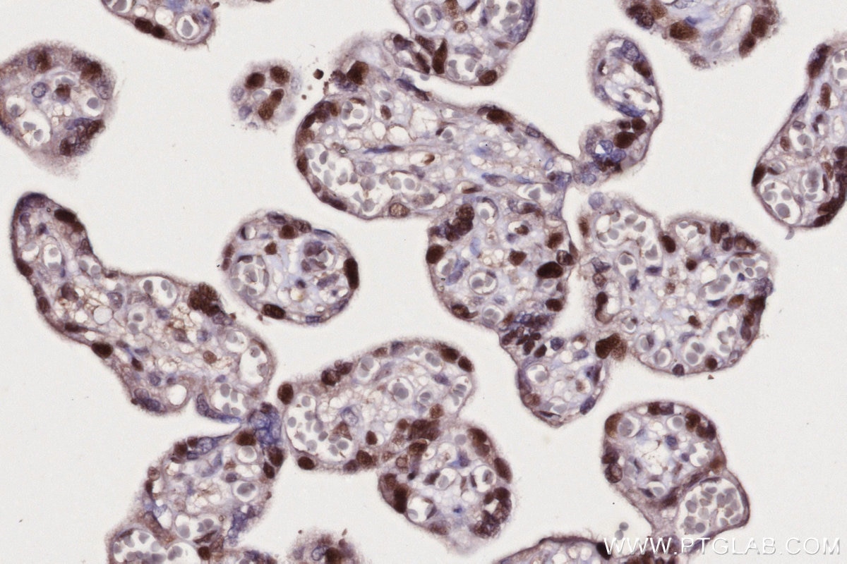 Immunohistochemical analysis of paraffin-embedded human placenta tissue slide using KHC2708 (UBA3 IHC Kit).